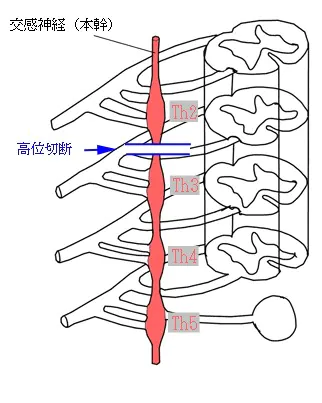 古典的ETS