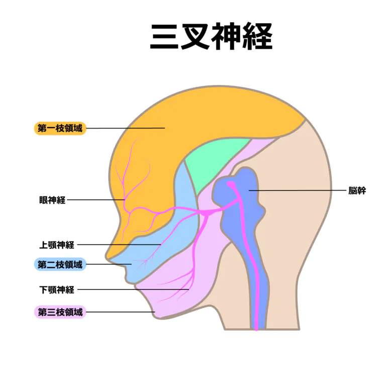 三叉神経痛