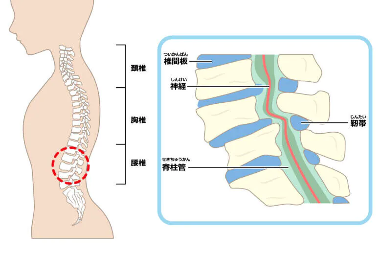 脊柱管狭窄症について