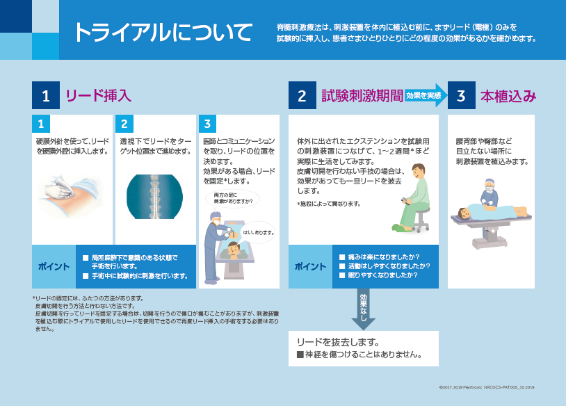 トライアルについて