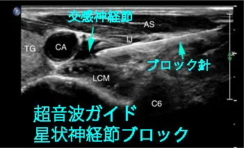 超音波エコーやレントゲン（X線）透視を使用